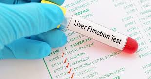 Liver Function Test