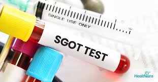 SGOT Test