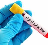 Lipid Profile Test