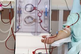 Dialysis