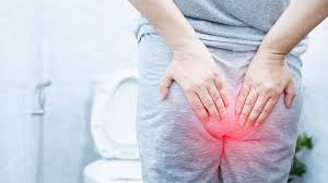 Rectal Bleeding