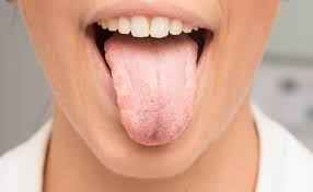 Dry Mouth